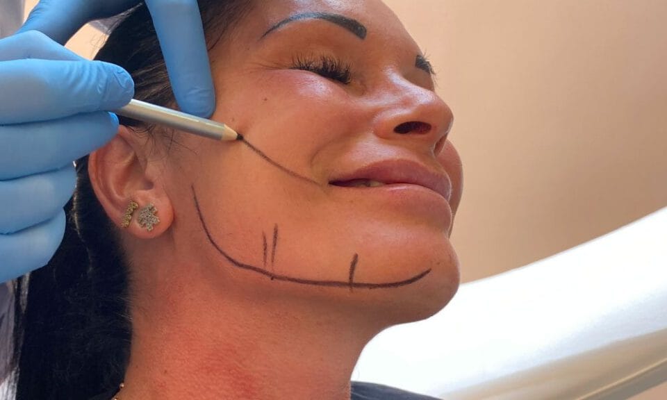 rimodellamento mandibola napoli